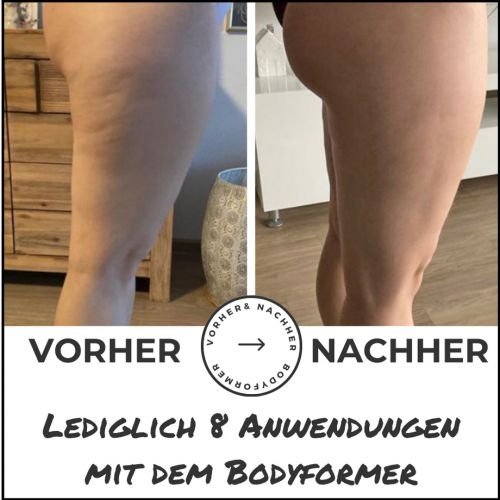 Straffe Beine und Po nach nur 8 Anwendungen mit dem Bodyformer